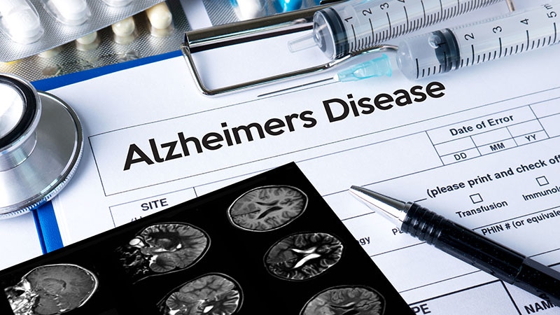 NICE: NHS Will Not Fund Donanemab for Alzheimer’s