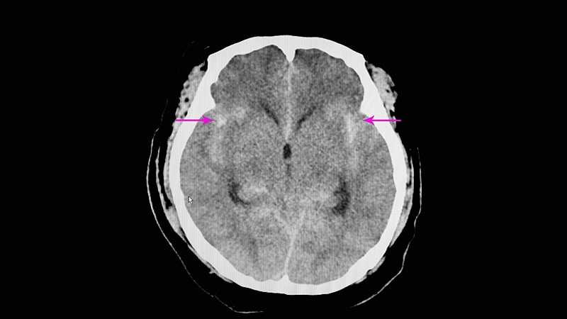 New Data to Alter Planned ICH Guidelines