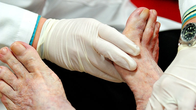 Diabetic Foot Guideline Compliance Good, But Could be Better