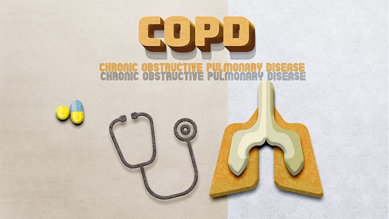 More Biologics Breaking Through for COPD