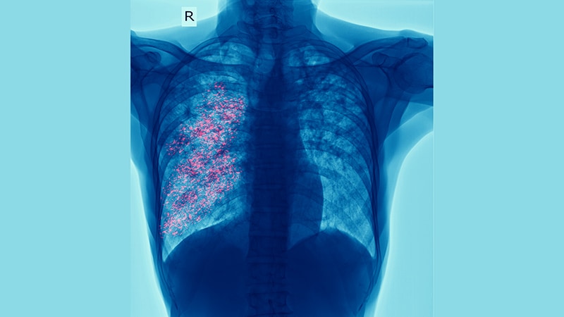 Persistence and Shifts in Occupational Lung Diseases