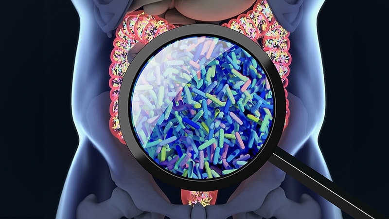 Panel Offers Best Practice Statement for Microbiota Testing