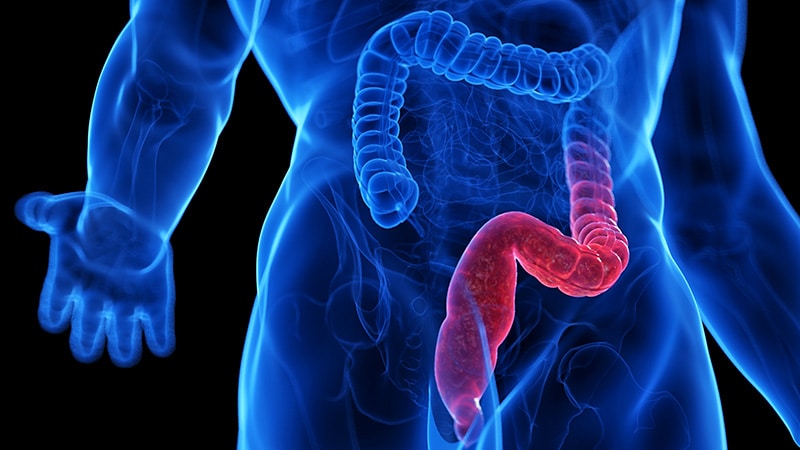 Noninvasive Microbiome Test May Identify Crohn’s and UC