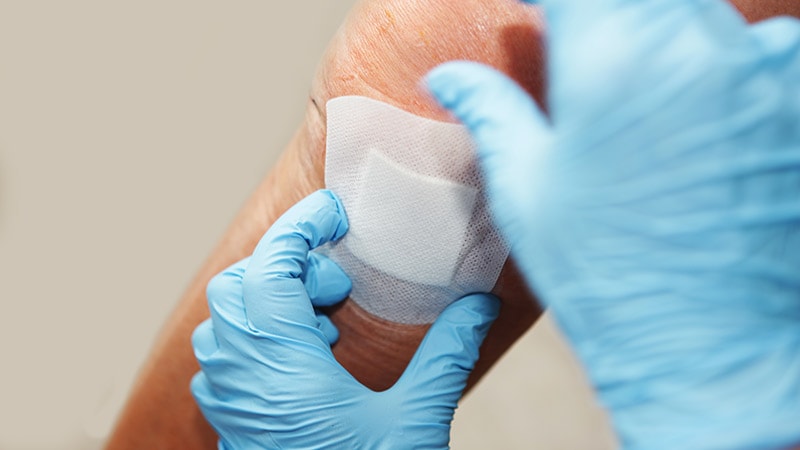 Wound Healing Toolbox Requires Frequent Updating