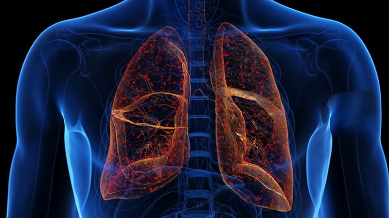 Imipenem-Cilastatin-Relebactam, the New Go-To for Pneumonia?